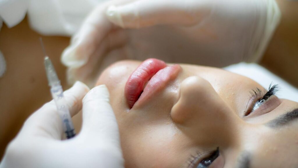 Lip Filler Dubai Craze: Achieve Instant Youthful Lips